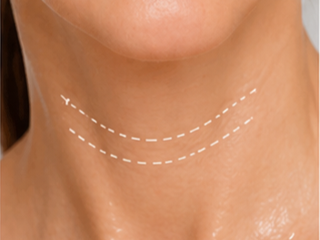 Cuello y escote