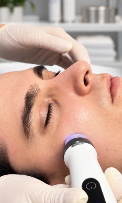 Dermapen - tratamiento de microneedling en HRocha